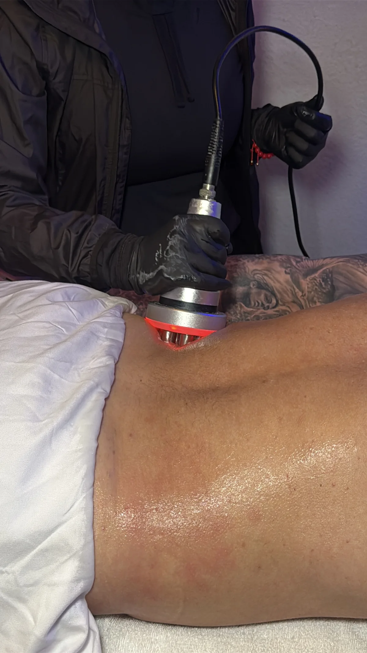 InstaSculpting treatment in progress in a professional setting